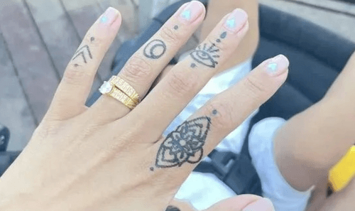 После татуировки хной у женщины остались шрамы на руке