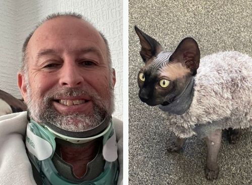 Разыгравшийся лысый кот уронил хозяина с лестницы, и мужчина получил множественные травмы