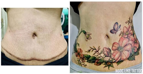 Молодая талантливая татуировщица помогает женщинам бороться со шрамами