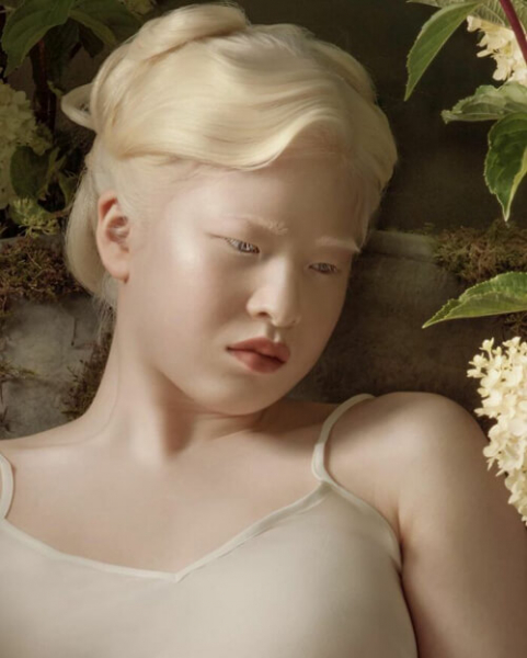 Девочка, от которой отказались из-за альбинизма, стала моделью