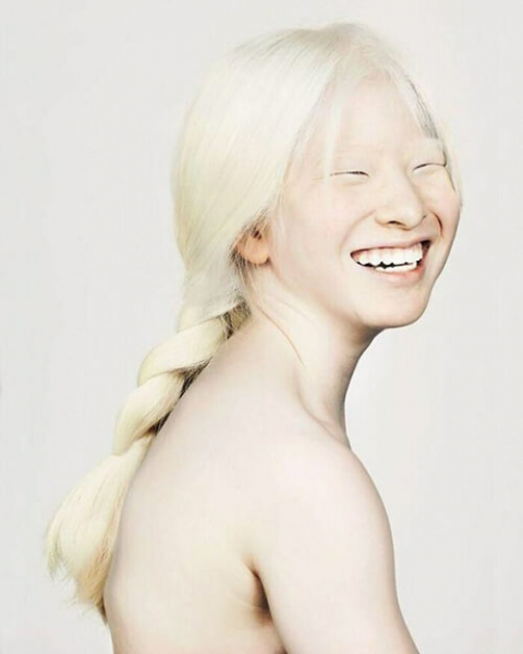 Девочка, от которой отказались из-за альбинизма, стала моделью