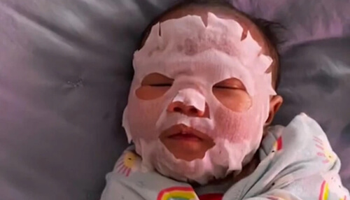 Малыш с раздражением кожи получил от мамы косметическую маску