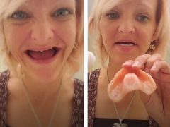 Мать семейства потеряла зубы и призывает людей не стесняться зубных протезов