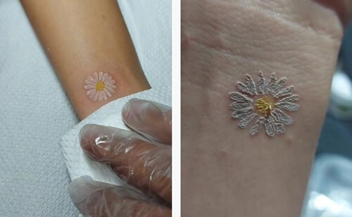Татуировка в виде цветочка исчезла с кожи почти без следа