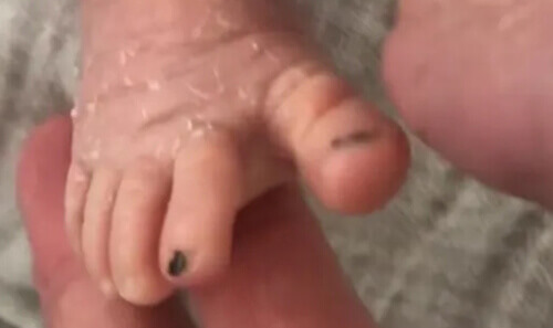 Мама, которая не может различать дочек-близняшек, красит одной из них ногти