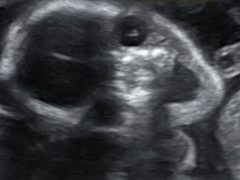 Беременная женщина испугалась, посмотрев на УЗИ-снимок своего ребёнка