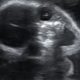 Беременная женщина испугалась, посмотрев на УЗИ-снимок своего ребёнка