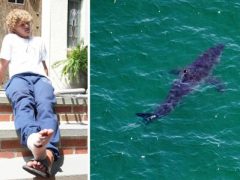 Юноша, шутивший об укусах акул, сам подвергся нападению акулы