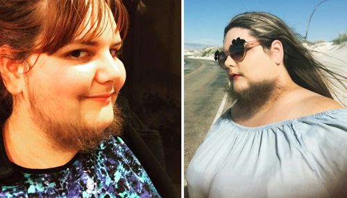 Женщина перестала брить лицо дважды в день и гордится своей бородой