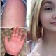 Девочка-подросток с ужасом выяснила, что у неё аллергия на воду