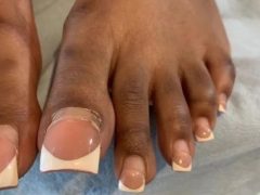 Дама умудрилась целых 13 недель ходить с акриловыми ногтями на ногах