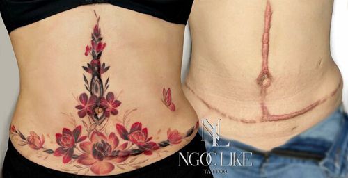 Художница с помощью татуировок помогает женщинам скрывать шрамы