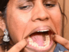 Женщина, у которой 38 зубов, попала в Книгу рекордов Гиннесса