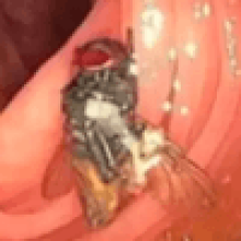 Во время колоноскопии врачи обнаружили живую муху в кишечнике пациента