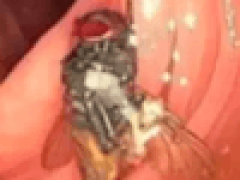 Во время колоноскопии врачи обнаружили живую муху в кишечнике пациента