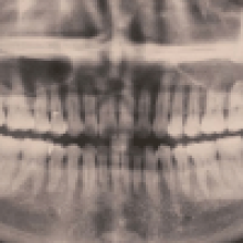 Рождественскую открытку случайно украсили рентгеновским снимком зубов