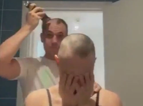 Чтобы поддержать возлюбленную с алопецией, мужчина сбрил себе волосы